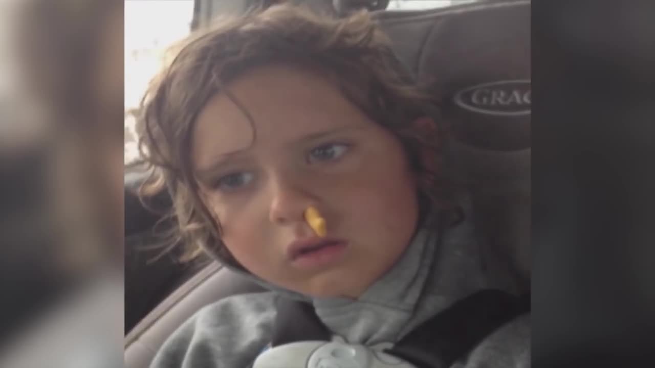 Goldfish In His Nose